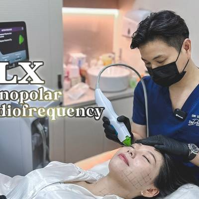 Thermage flx cost